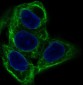 Anti-Cytokeratin 20 KRT20 Rabbit Monoclonal Antibody